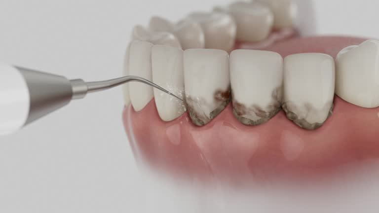Trusted Dental Crowns And Bridges service in Basin, WY - Dentist Open Now